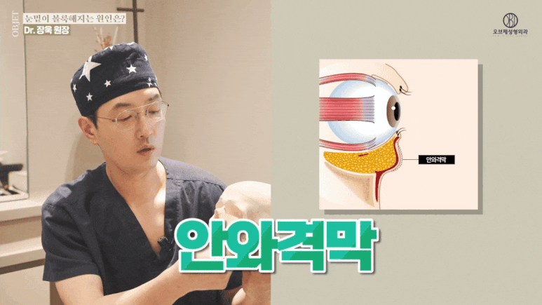 눈밑지방재배치 유지기간 성형외과 의사가 밝히는 2가지 진실! 관련 이미지 7