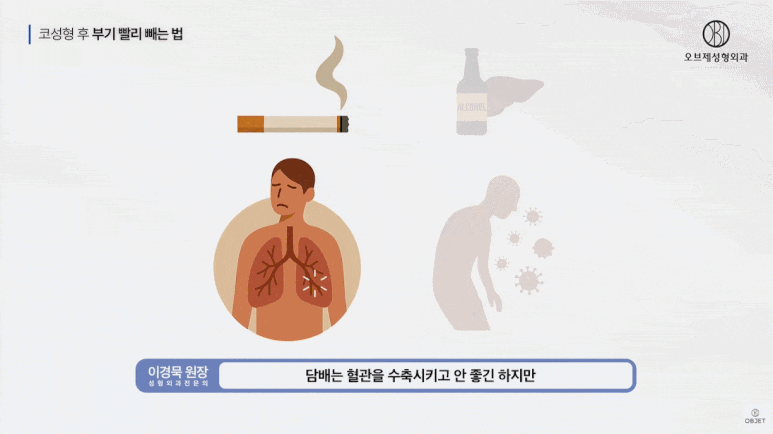Rhinoplasty Swelling Period and Walking: What Matters More Than Pumpkin Juice Is the Doctor’s ○○○? image 17