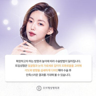 강남 쌍꺼풀수술 나에게 맞게하는 방법 관련 이미지 9