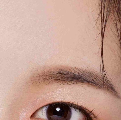 Why Dark Circle Treatment in Gangnam Requires Careful Consideration image 9