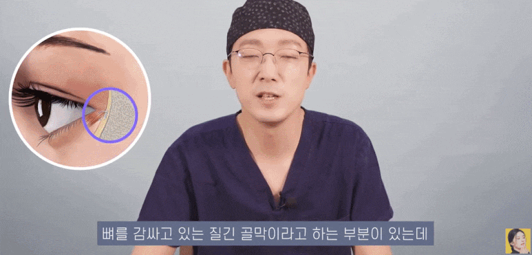 Don’t Get Surgery Without Knowing the Lower Blepharoplasty Method! Plastic Surgery Knowledge from Objet Plastic Surgery image 9