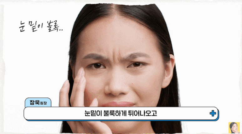 눈밑지 재발 이유? 세 가지만 알면 눈밑지방재배치 성공할 수 있어요! 관련 이미지 2