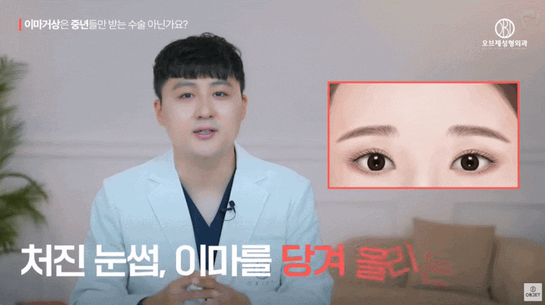 40대 이마거상과 20대 30대의 이마거상의 차이점 전격 비교! (성형외과 전문의 설명) 관련 이미지 3