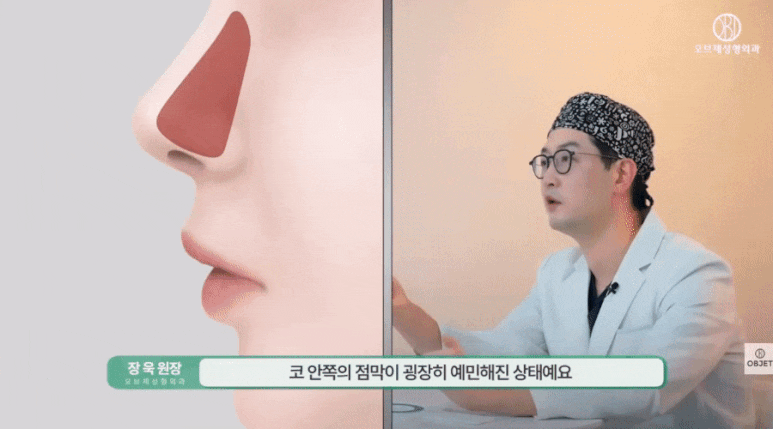 코수술 콧구멍 짝짝이되는 거 아니겠죠? 장욱 원장님 답변! 관련 이미지 10