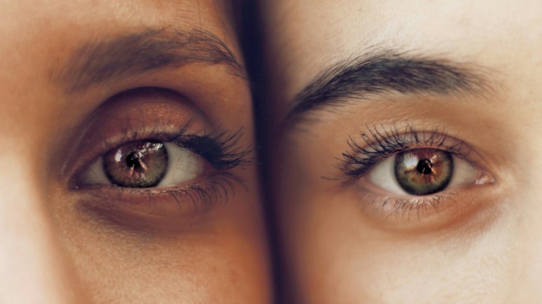Dark Circle Causes: Are They Really This Diverse? image 2