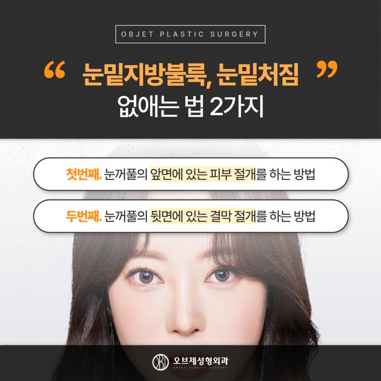 오브제성형외과 신종인 원장님, 눈밑성형 1초만에 결정 관련 이미지 3