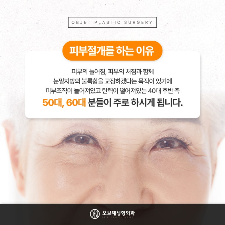 오브제성형외과 신종인 원장님, 눈밑성형 1초만에 결정 관련 이미지 5