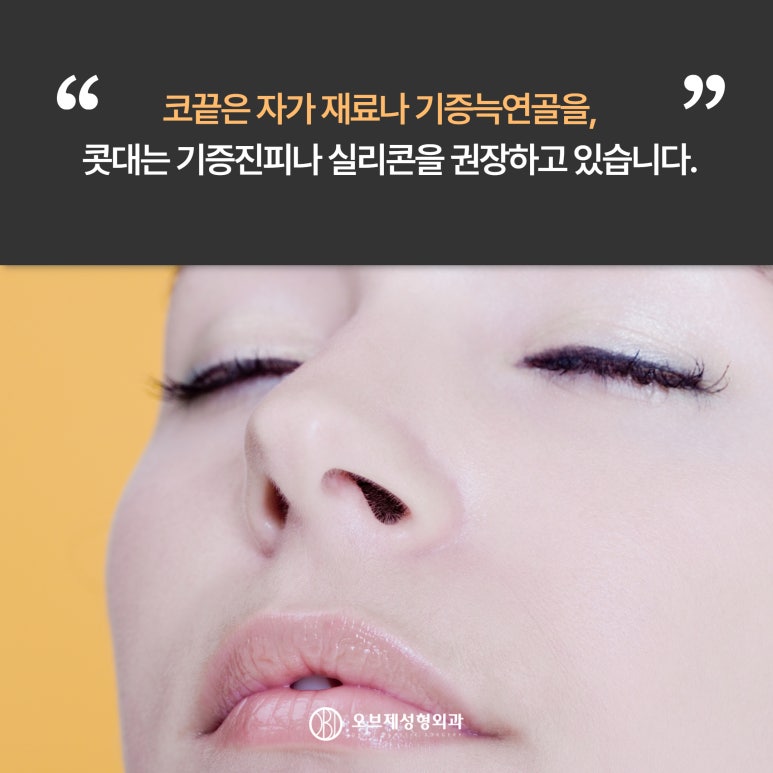 Conditions for Non-Implant Rhinoplasty image 6