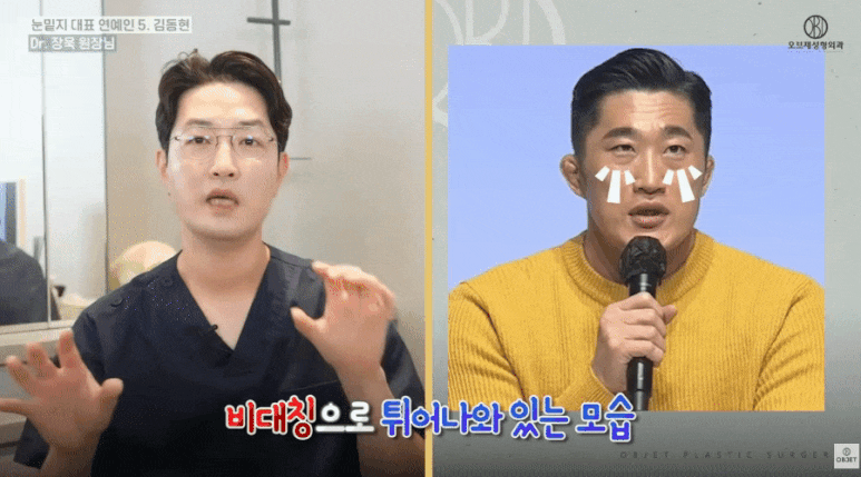 눈밑지방재배치 연예인 TOP 5! 장욱 원장님이 분석해 드립니다 관련 이미지 10