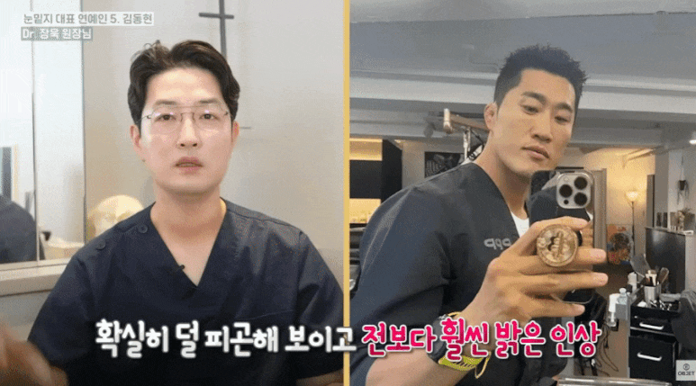 눈밑지방재배치 연예인 TOP 5! 장욱 원장님이 분석해 드립니다 관련 이미지 11