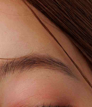 Questions About Double Eyelid Surgery in Gangnam image 10