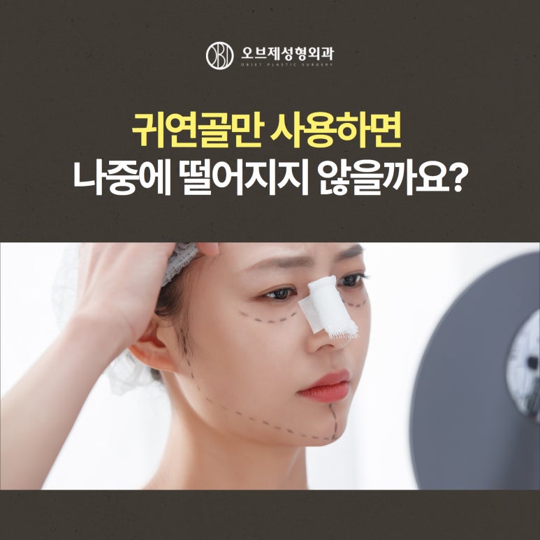 Natural Tip Rhinoplasty #Yeoksam-dong#Gangnam image 13