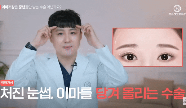 Can Forehead Lift Surgery Improve the Ability to Open Your Eyes Before and After? Dr. Hyun-jo Kim Explains! image 3