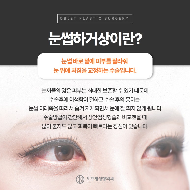 처진 눈두덩이 끌어올리는 방법, 눈썹하거상 관련 이미지 6