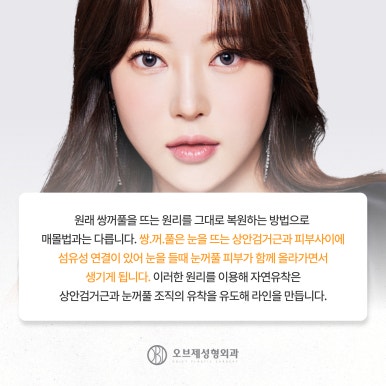 강남 쌍꺼풀수술 나에게 맞게하는 방법 관련 이미지 5