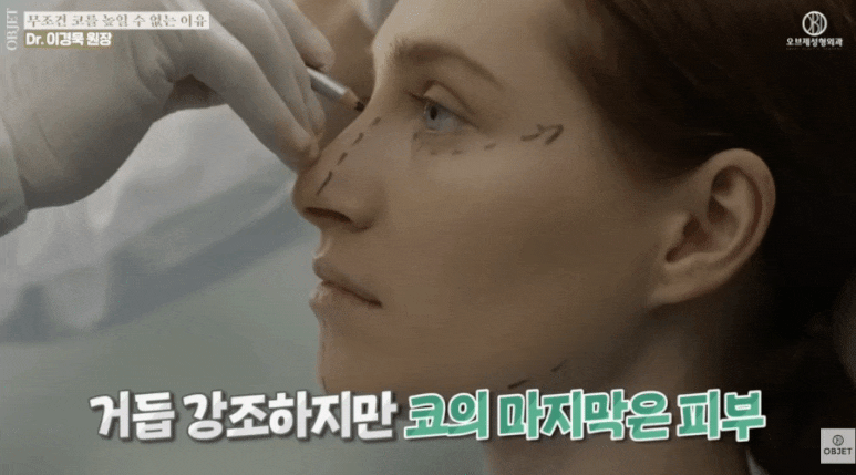 Is It Always Possible to Raise the Tip of the Nose? Director Lee Kyung-mook's Answer! image 3
