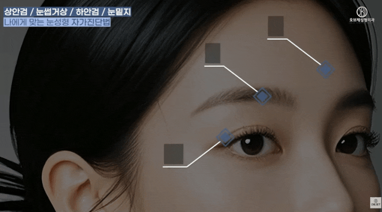 Worried About Choosing Midlife Eye Surgery? Director Kim Hyun-jo Will Set It Straight image 3