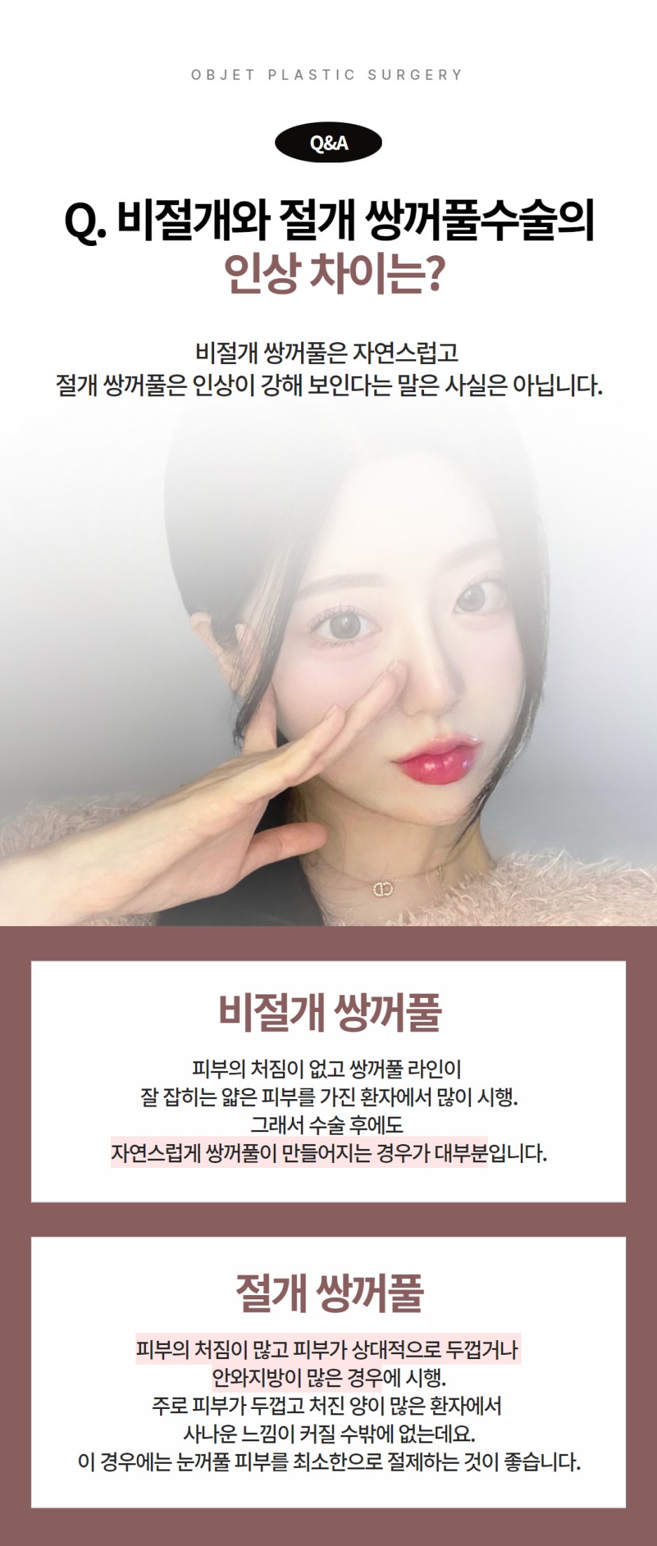 Questions About Double Eyelid Surgery in Gangnam image 4