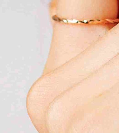 The Difference Between Upper Blepharoplasty and Incisional Double Eyelid Surgery #Director Kim Hyun-jo image 14