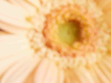 비염수술 병원 어디로 가야 할까요? 관련 이미지 15