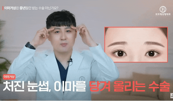 The Effects of a Forehead Lift in Your 20s? A Comprehensive Summary by Director Kim Hyun-jo image 5