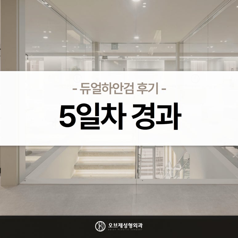 듀얼하안검 후기, 수술당일부터 69일까지 생생보고 #오브제성형외과 장욱원장님 관련 이미지 13