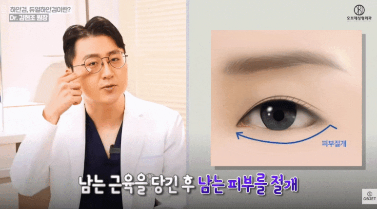 하안검 뜻? 김현조 원장님이 눈밑 고민 해결해 드립니다! 관련 이미지 2