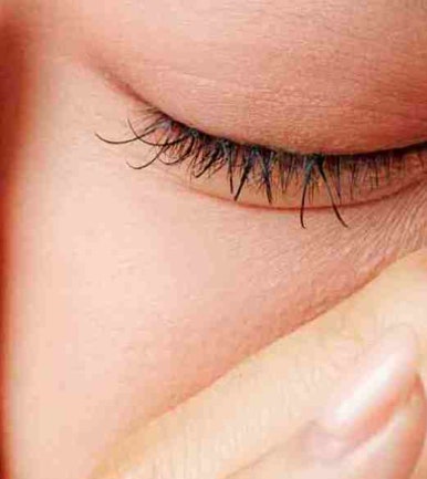 The Difference Between Upper Blepharoplasty and Incisional Double Eyelid Surgery #Director Kim Hyun-jo image 12