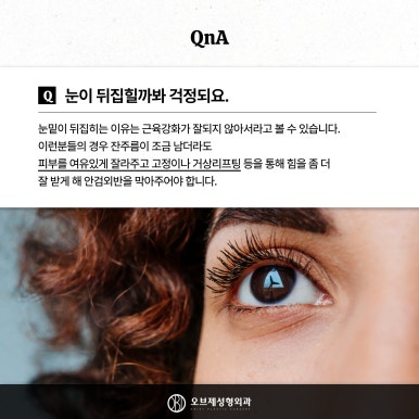 눈밑 뒤집힘, 애교살, 흉터 등 하안검수술 부작용 관련 이미지 5