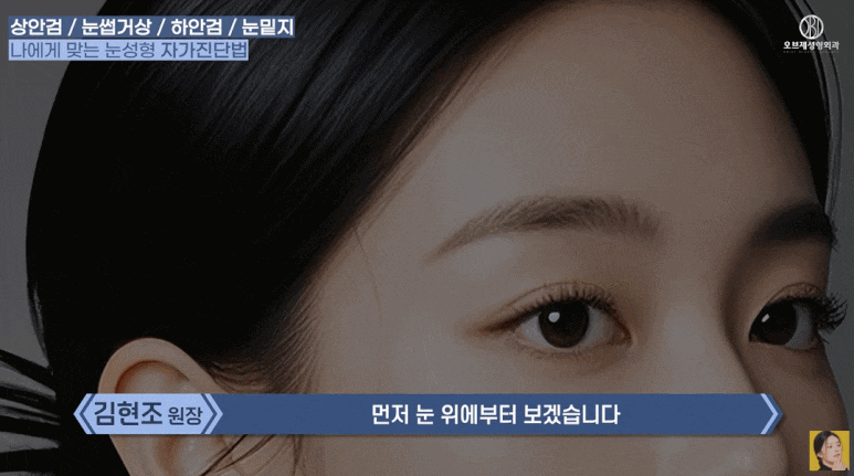 What Is the Difference Between Upper Eyelid and Lower Eyelid Surgery? Are There Different Procedures for Different Eyes? (Explanation by a Board-Certified Plastic Surgeon) image 5
