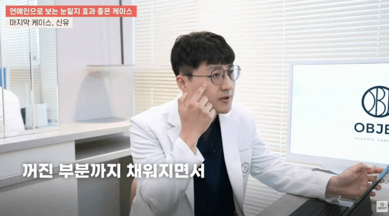 눈밑지 병원? 관련 이미지 12