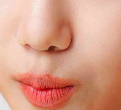 강남지방이식 흡수율 얼마나 되나요? 관련 이미지 16