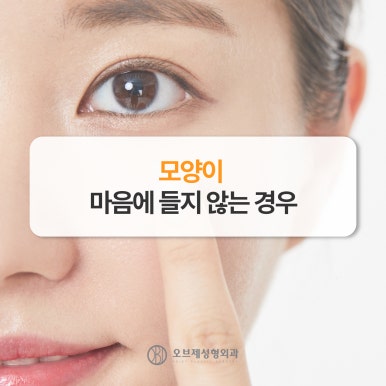 Where to Get Good Revision Eye Surgery: 고민 After a First Failure image 5