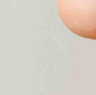Various Types of Gangnam Thread Lifting image 11