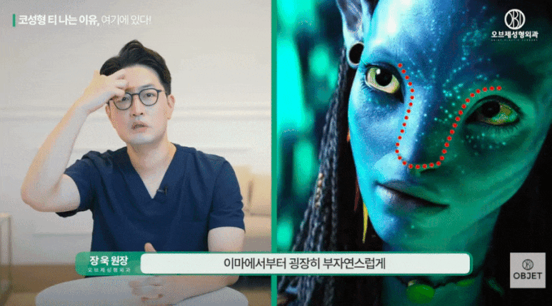 코성형 하기전, 꼭 알아야 할 관련 이미지 3