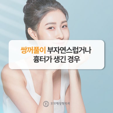 Where to Get Good Revision Eye Surgery: 고민 After a First Failure image 3