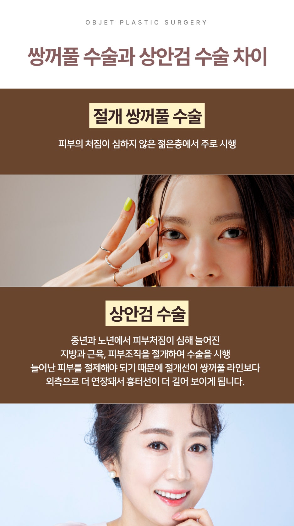 The Difference Between Upper Blepharoplasty and Incisional Double Eyelid Surgery #Director Kim Hyun-jo image 4