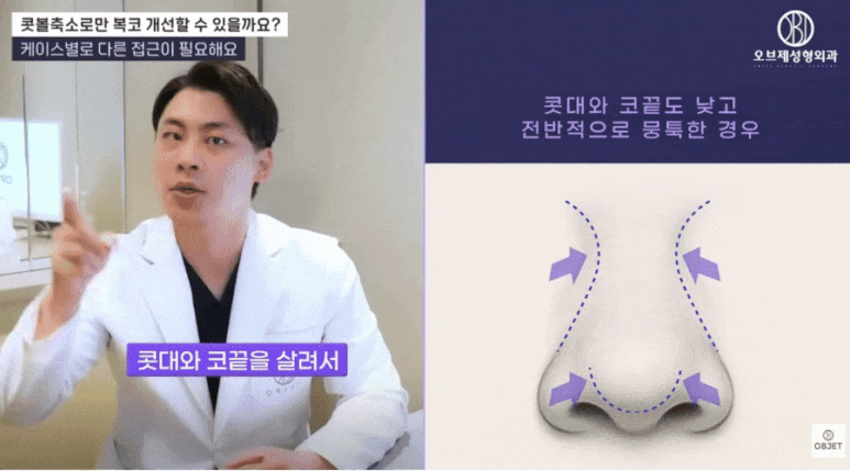 Nasal Ala Reduction Surgery: Selection Criteria as Explained by Director Park Si-hyun image 5