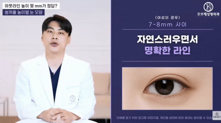 What Is the Pretty Height for an Out-Line Double Eyelid? Director Park Si-hyeon’s Answer! image 4