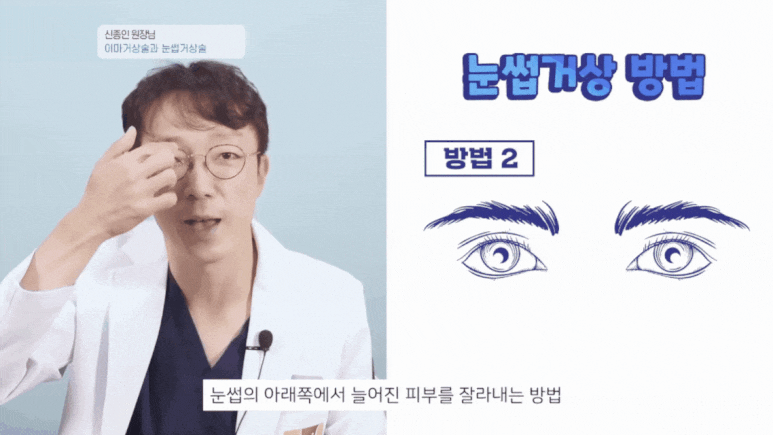 Forehead and Eyebrow Lift? A Selection Guide from Director Shin Jong-in image 6