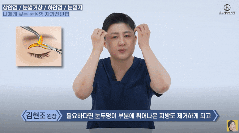 What Is the Difference Between Upper Eyelid and Lower Eyelid Surgery? Are There Different Procedures for Different Eyes? (Explanation by a Board-Certified Plastic Surgeon) image 10