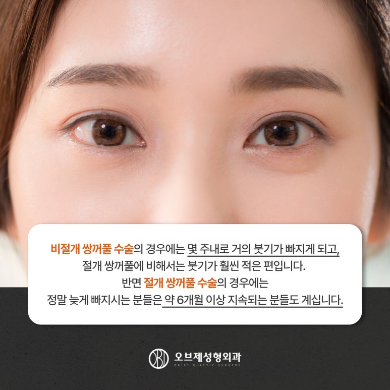 Postoperative Care After Double Eyelid Surgery: Precautions for a Faster Recovery image 4