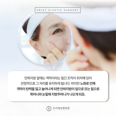 늘어지고 처지는 중년눈수술 관련 이미지 6