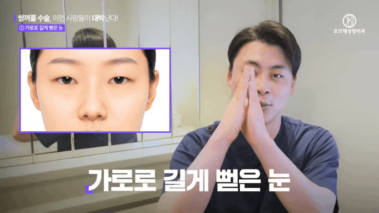 Why Double Eyelid Surgery Fails: The Crucial Difference Between Those It Works For and Those It Doesn’t image 4