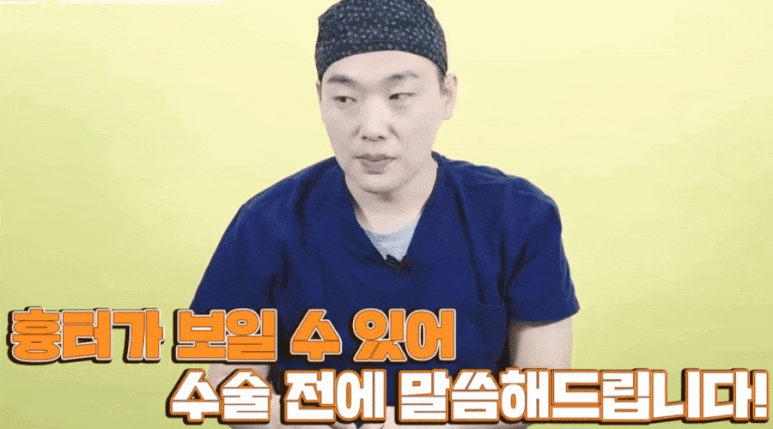 Tip Rhinoplasty: Don’t Overlook the Columella! A Summary by Dr. Lee Kyung-mook image 11