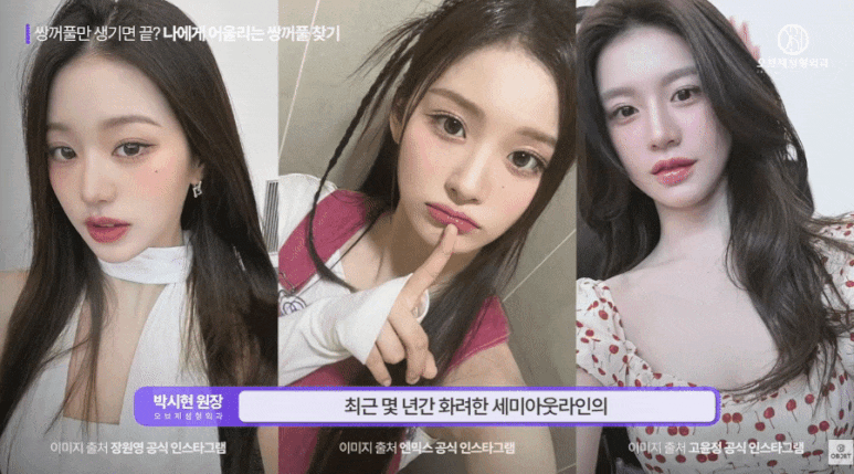 쌍수 후기 라인 보지 마세요! 박시현 원장님의 선택 기준! 관련 이미지 3