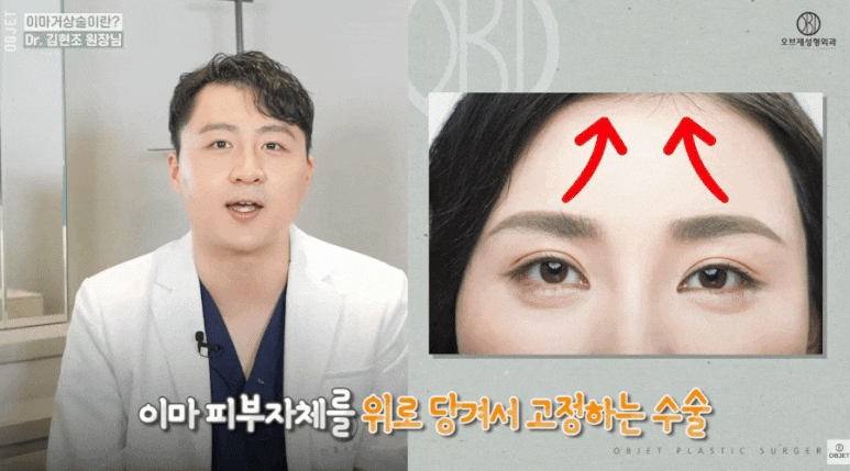 Three Eyelid Drooping Surgeries Explained by Director Kim Hyun-jo! image 9