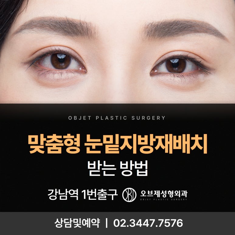 Undereye Fat Repositioning: The Method That’s Right for Me image 1