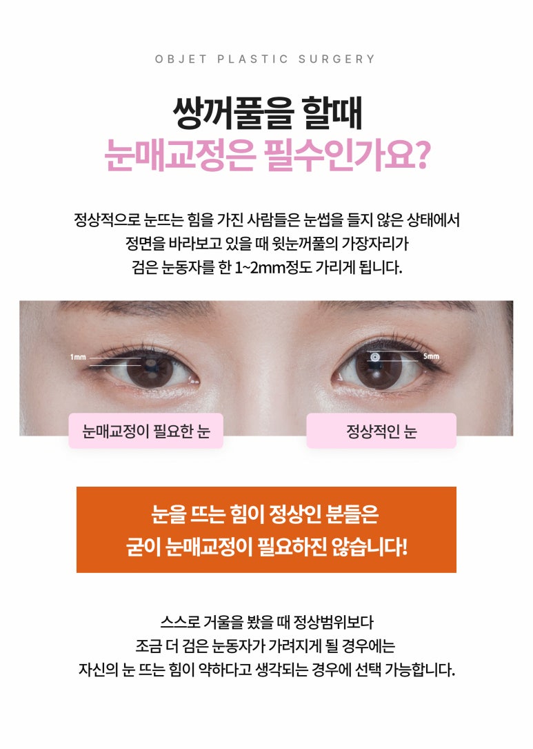 눈매교정수술추천 절개와 비절개 어떤게 나에게 필요할까? 관련 이미지 5