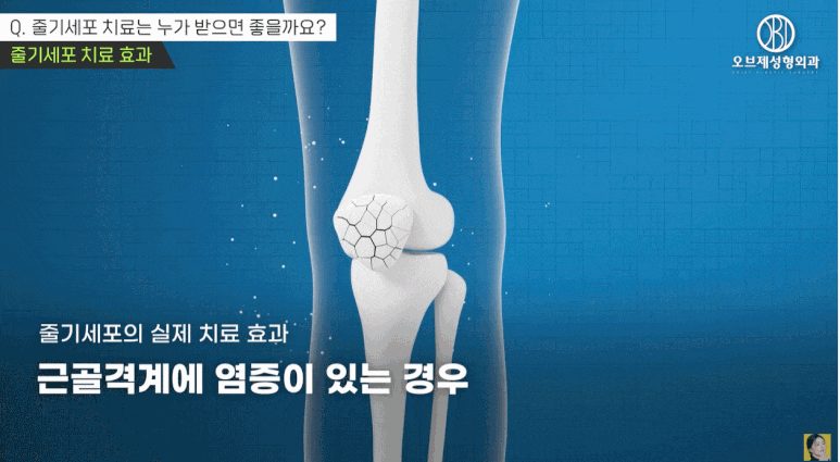 What Are the Types and Effects of Stem Cell Injections? I’ll Explain It Simply (Answer from a Plastic Surgeon) image 9